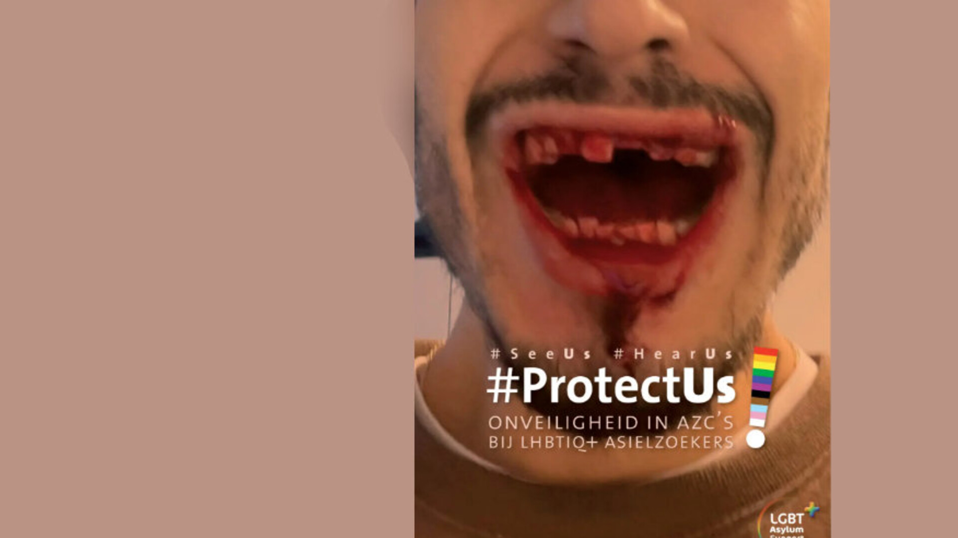 Titelpagina van het rapport 'Protect Us': man wiens tanden uit zijn mond zijn  gelsagen (incident beschreven in rapport)